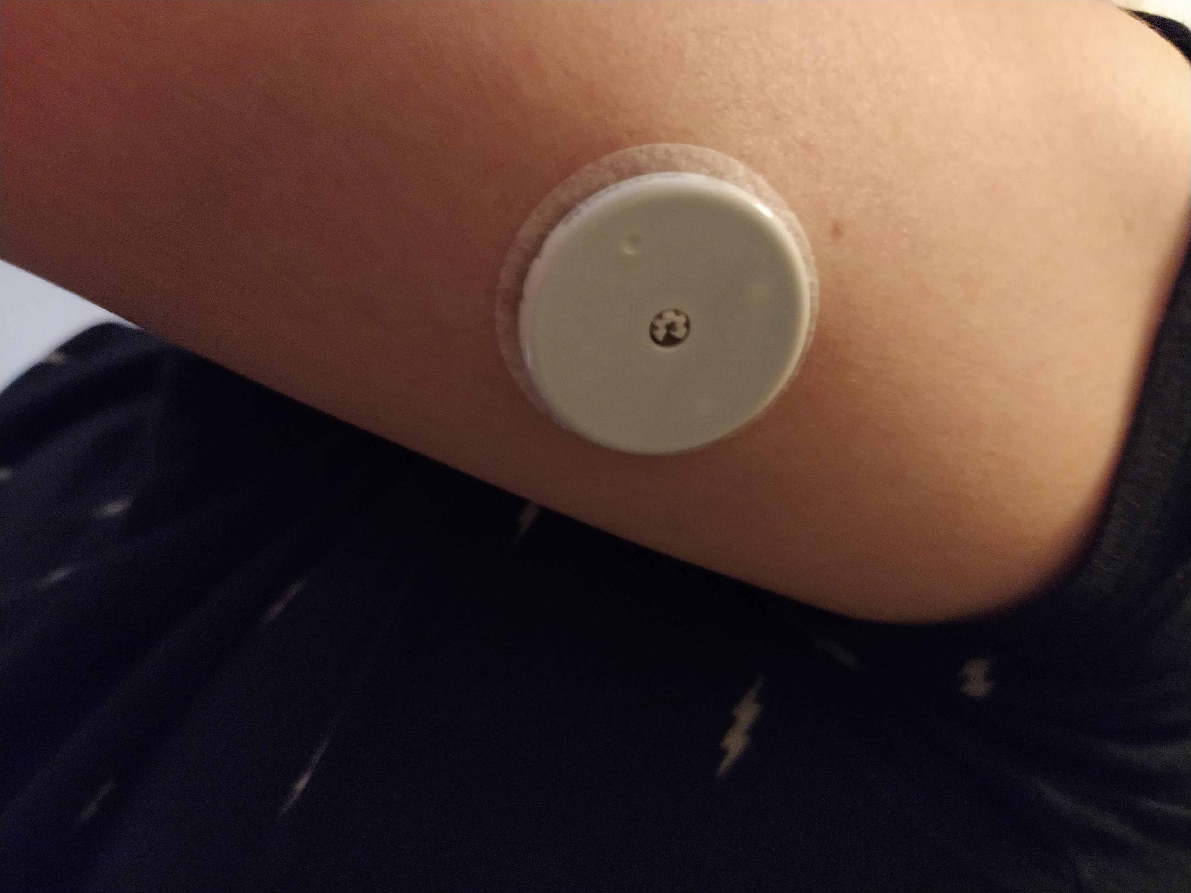 I Wore a Continious Glucose Monitor for 2 Weeks